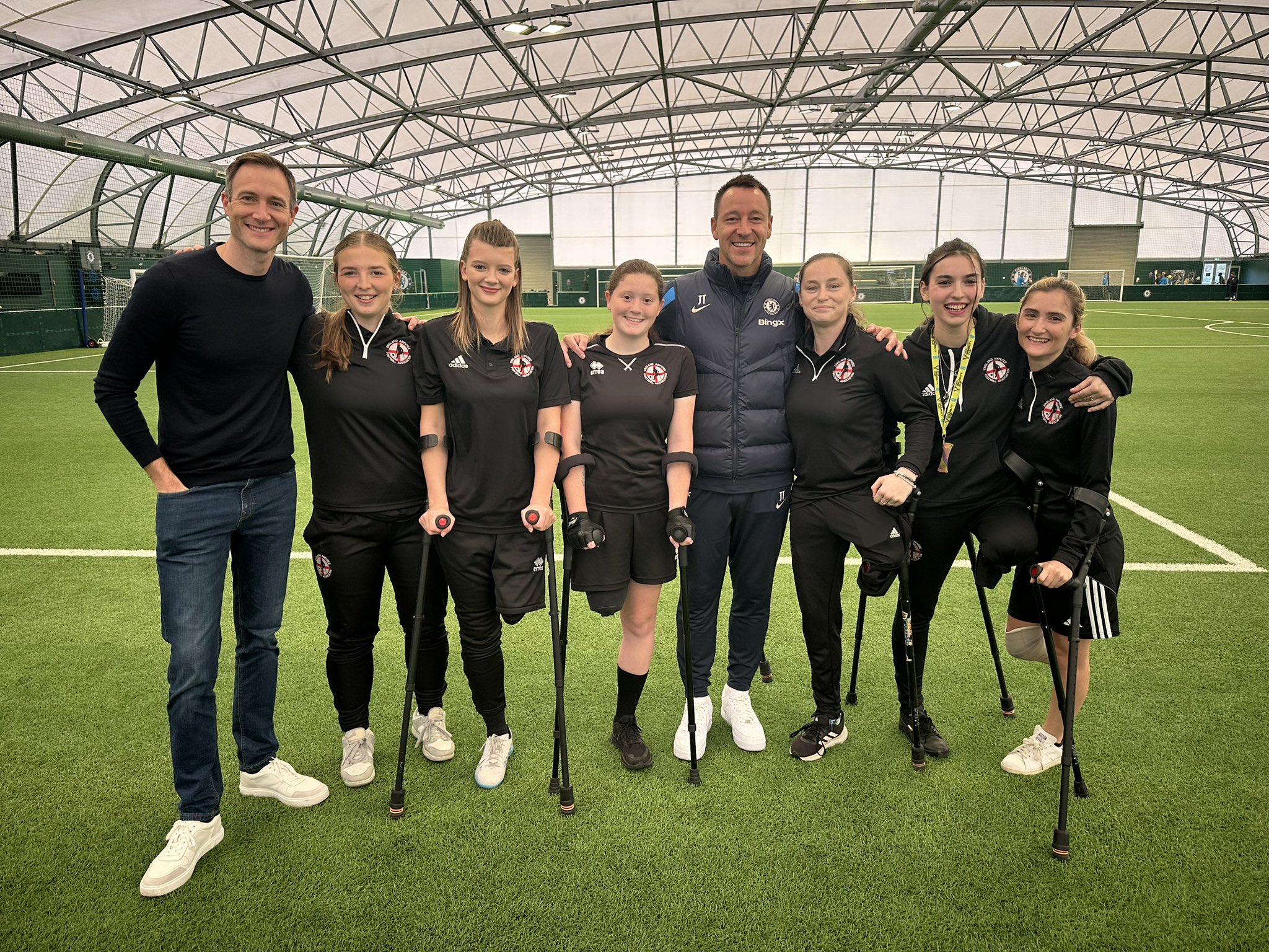 John Terry Amputee